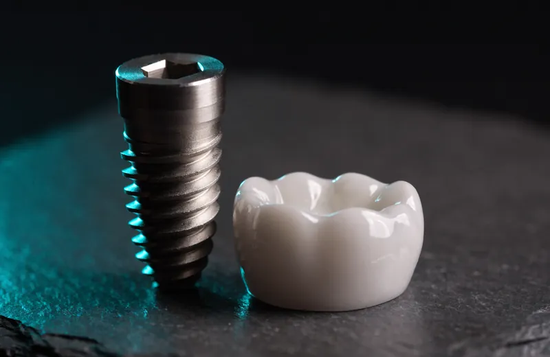 Titanium dental implant and zirconia crown photographed on a dark slate surface