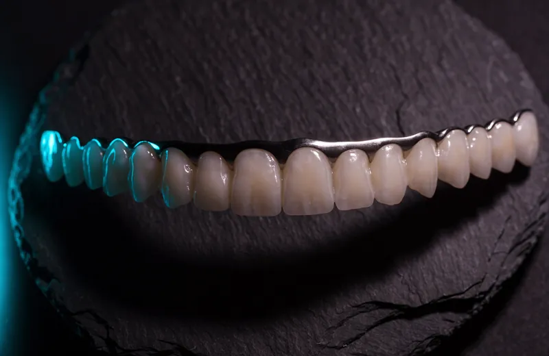 Full-arch dental prosthesis on a titanium bar, photographed on dark slate