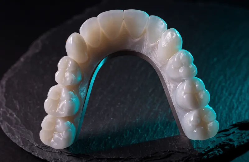 Monolithic zirconia full-arch prosthesis on a titanium bar, lit from the edge
