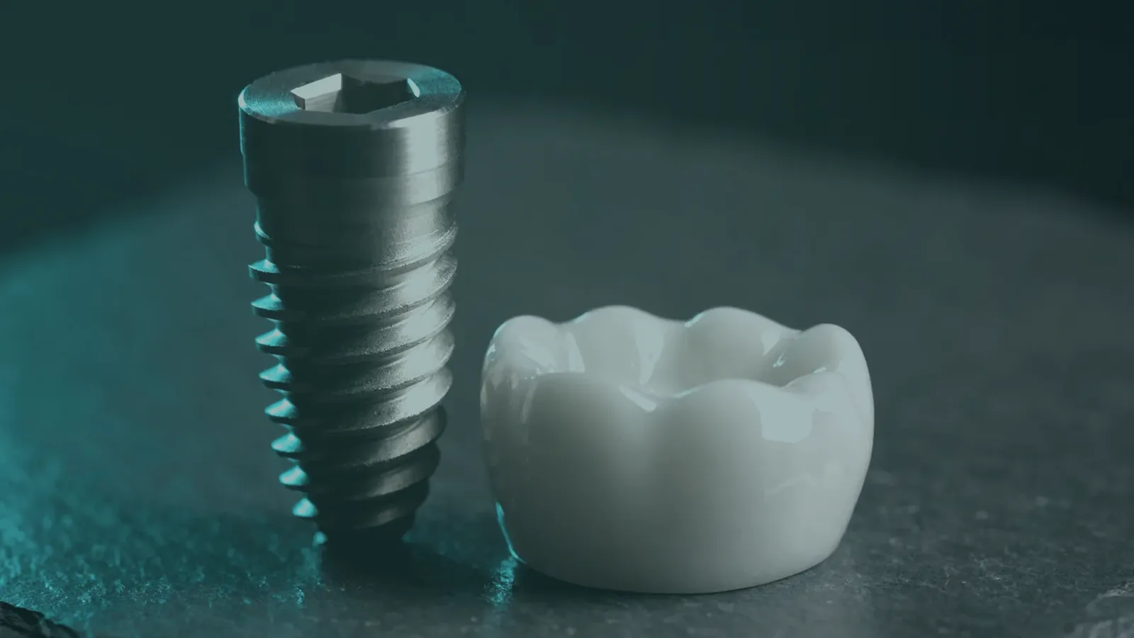 What a dental implant actually costs in Turkey, itemised