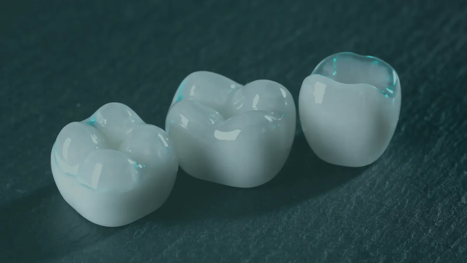 Zirconia or e.max: which crown belongs on which tooth
