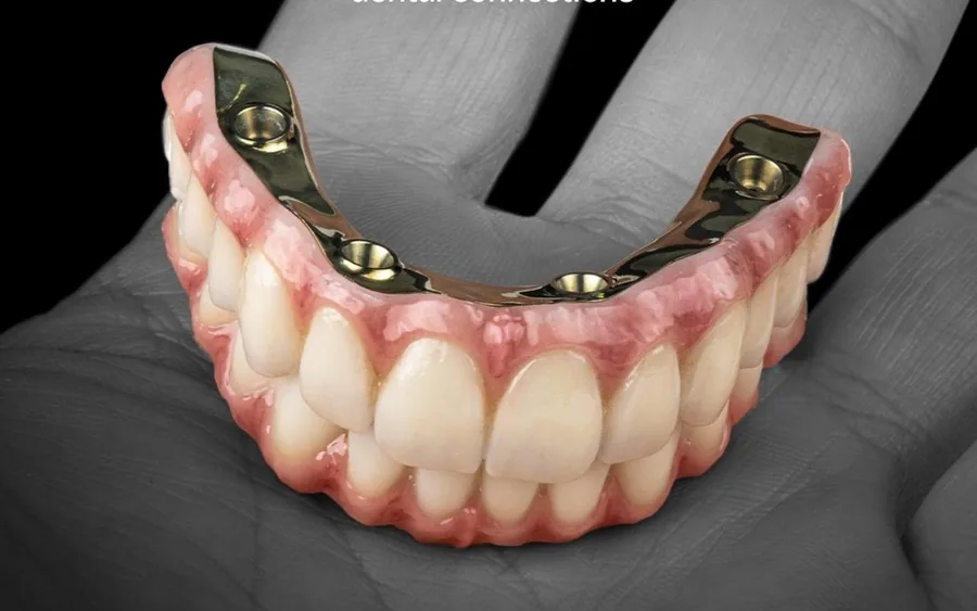Close-up of a zirconium hybrid prosthesis produced for a VeaHealth patient